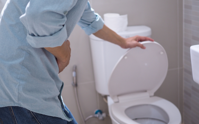 Ulcerative Colitis